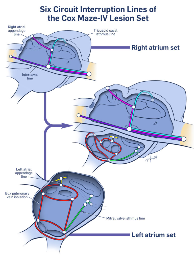 Define Maze Procedure